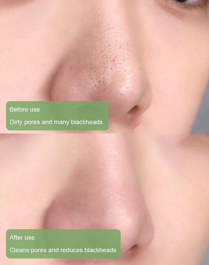 100% Natural Green Tea Deep Cleanse Mask