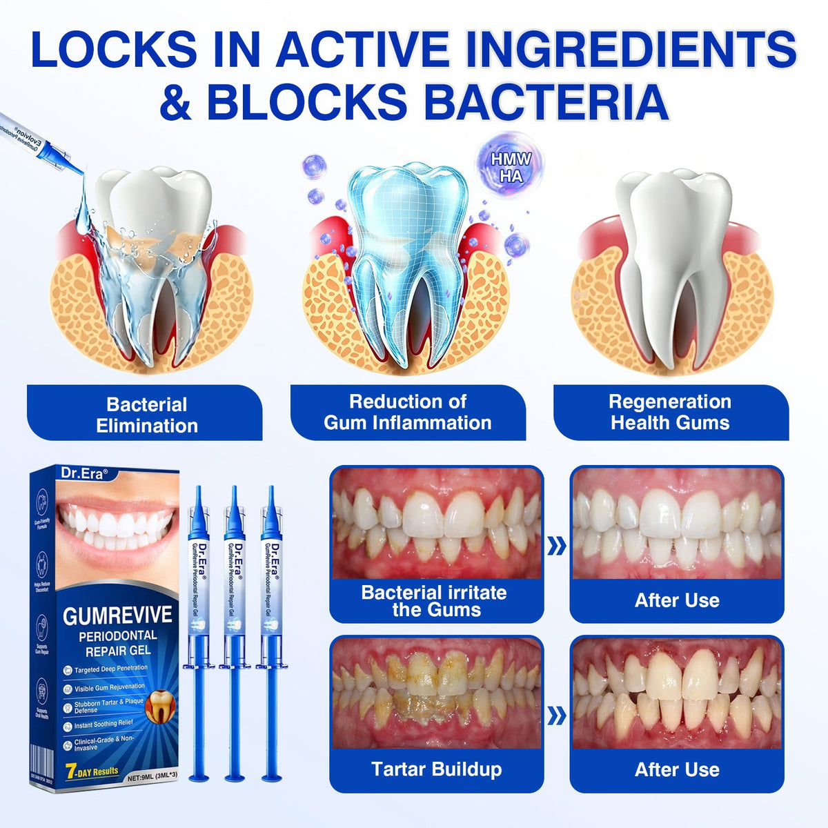 🦷 Periodontal RepairGel - Targeted Gumline Supportfor Plaque, Cavities, PeriodontalConcerns, Bad Breath & WeakTeeth Precision Leave-On OralCare Formula