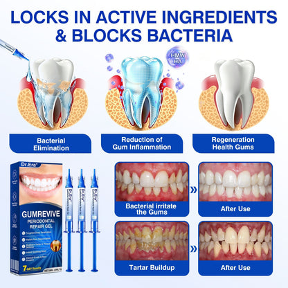 🦷 Periodontal RepairGel - Targeted Gumline Supportfor Plaque, Cavities, PeriodontalConcerns, Bad Breath & WeakTeeth Precision Leave-On OralCare Formula