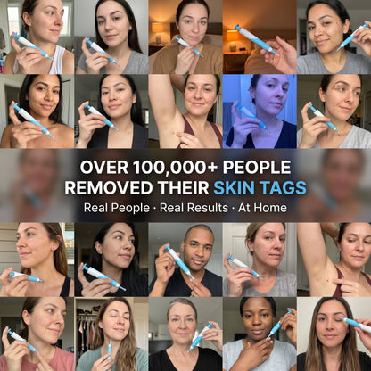 7-Day Skin Tag Remover Kit