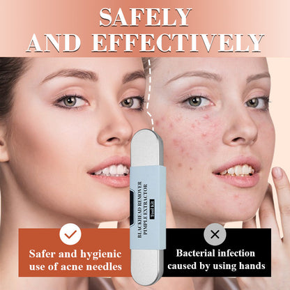 🔥Limit Time 50% OFF🔥Stainless Steel Blackhead Remover Tool Kit