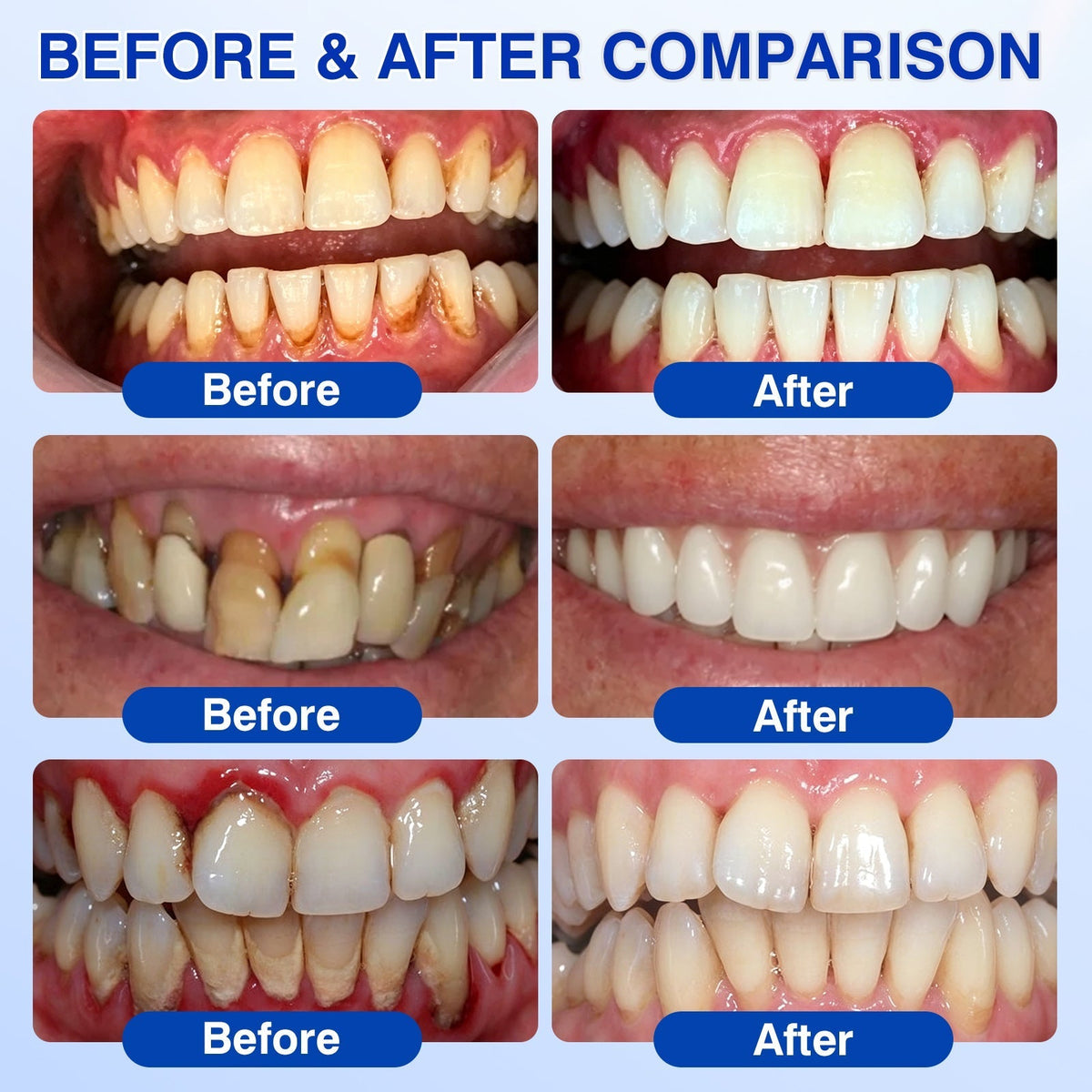 🦷 Periodontal RepairGel - Targeted Gumline Supportfor Plaque, Cavities, PeriodontalConcerns, Bad Breath & WeakTeeth Precision Leave-On OralCare Formula