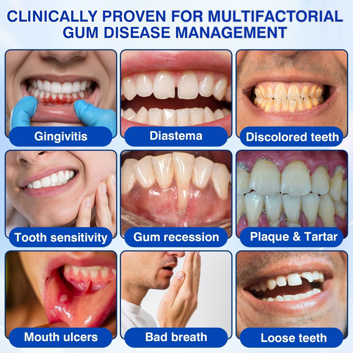 🦷 Periodontal RepairGel - Targeted Gumline Supportfor Plaque, Cavities, PeriodontalConcerns, Bad Breath & WeakTeeth Precision Leave-On OralCare Formula