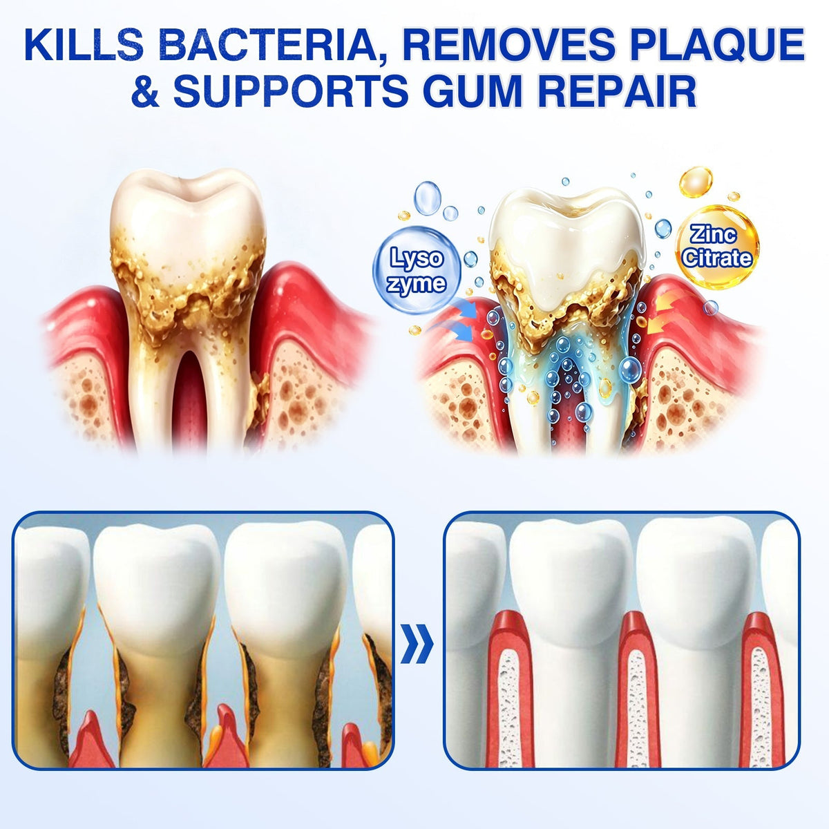 🦷 Periodontal RepairGel - Targeted Gumline Supportfor Plaque, Cavities, PeriodontalConcerns, Bad Breath & WeakTeeth Precision Leave-On OralCare Formula