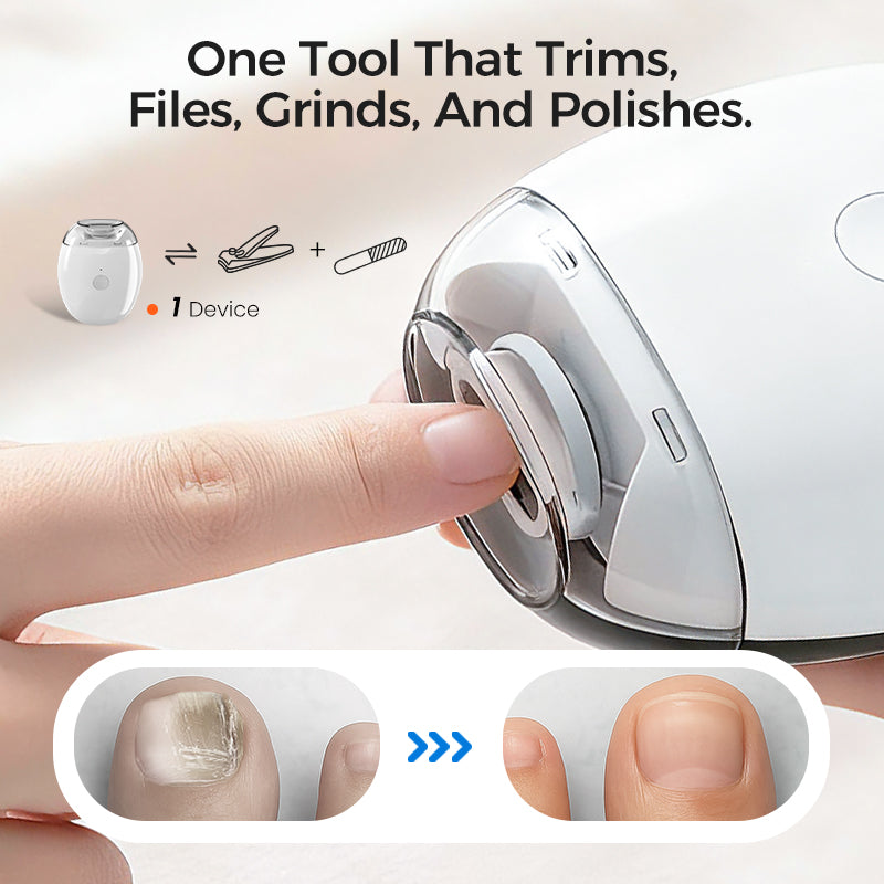 🏆Flash Sale⚡50K+ SOLD! Universal Automatic Fingernail Grinder for Adults and Children