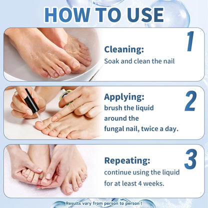 Maximum Intensity Nail Fungus Treatment